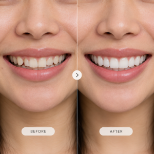 Cosmetic dentistry smile changeover